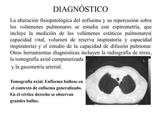 Dificultad respiratoriaDIAGNÓSTICO El diagnóstico temprano del cáncer de pulmón es el principal condicionante para el éxito en su tratamiento. En estadios tempranos, el cáncer de pulmón puede, en alrededor del 20% de los casos, ser tratado mediante resecciónquirúrgica con éxito de curación.Sin embargo, debido a su virulencia y a la dificultad para su detección precoz, en lamayoría de los casos de diagnóstico dondeya ocurre metástasis; el cáncer de pulmón presenta, junto con el cáncer de hígado, páncreas y esófago, los pronósticos peores, con una esperanza de vida promedio aproximadamente 8 meses. 