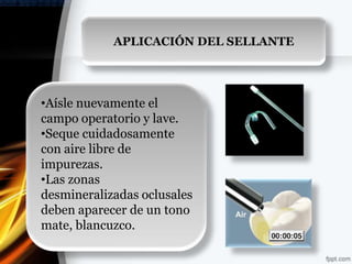 APLICACIÓN DEL SELLANTE




•Aísle nuevamente el
campo operatorio y lave.
•Seque cuidadosamente
con aire libre de
impurezas.
•Las zonas
desmineralizadas oclusales
deben aparecer de un tono
mate, blancuzco.
 