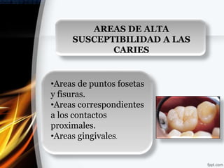 AREAS DE ALTA
     SUSCEPTIBILIDAD A LAS
            CARIES


•Areas de puntos fosetas
y fisuras.
•Areas correspondientes
a los contactos
proximales.
•Areas gingivales.
 