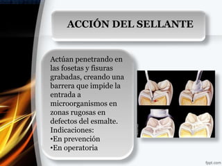 ACCIÓN DEL SELLANTE


Actúan penetrando en
las fosetas y fisuras
grabadas, creando una
barrera que impide la
entrada a
microorganismos en
zonas rugosas en
defectos del esmalte.
Indicaciones:
•En prevención
•En operatoria
 
