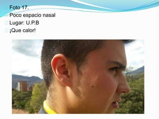 Foto 17.
Poco espacio nasal
Lugar: U.P.B
¡Que calor!
 