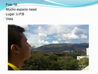 Foto 18.
Mucho espacio nasal
Lugar: U.P.B
Vista
 