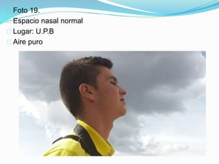 Foto 19.
Espacio nasal normal
Lugar: U.P.B
Aire puro
 