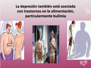 La depresión también está asociada
 con trastornos en la alimentación,
      particularmente bulimia
 