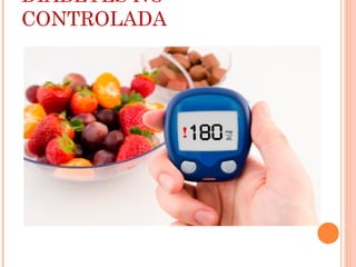 DIABETES NO
CONTROLADA
 
