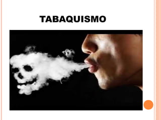 TABAQUISMO
 