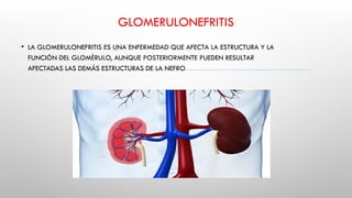 GLOMERULONEFRITIS
• LA GLOMERULONEFRITIS ES UNA ENFERMEDAD QUE AFECTA LA ESTRUCTURA Y LA
FUNCIÓN DEL GLOMÉRULO, AUNQUE POSTERIORMENTE PUEDEN RESULTAR
AFECTADAS LAS DEMÁS ESTRUCTURAS DE LA NEFRO
 