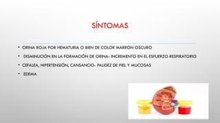 SÍNTOMAS
• ORINA ROJA POR HEMATURIA O BIEN DE COLOR MARRÓN OSCURO
• DISMINUCIÓN EN LA FORMACIÓN DE ORINA- INCREMENTO EN EL ESFUERZO RESPIRATORIO
• CEFALEA, HIPERTENSIÓN, CANSANCIO- PALIDEZ DE PIEL Y MUCOSAS
• EDEMA
 