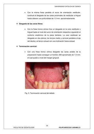 UNIVERSIDAD CATÓLICA DE CUENCA



            •   Con la misma fresa paralela al surco de orientación vestibular,
                continué el desgaste de las caras proximales de vestibular a lingual
                hasta obtener una profundidad de 1.5 mm. aproximadamente.

    Desgaste de las caras libres:


            •   Con la fresa tronco cónica hice un desgaste en la cara vestibular y
                lingual hasta el nivel del surco de orientación respectivo siguiendo el
                contorno anatómico de la pieza dentaria. La cara vestibular se
                desgasta en dos planos; los tercios medio y cervical paralelos al eje
                del diente y el tercio oclusal con una inclinación hacia oclusal.

    Terminación cervical:


            •   Con una fresa tronco cónica desgaste las caras axiales de la
                preparación hasta conseguir un hombro 360 aproximado de 1.5 mm;
                el cual quedó a nivel del margen gingival.




            Fig. 5. Terminación cervical del tallado




                                         10
FACULTAD DE ODONTOLOGÍA                                    FELIPE MOSCOSO JARAMILLO
 