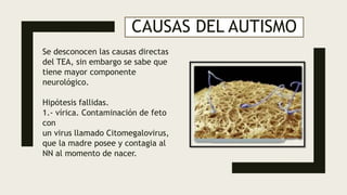 trabajo de investigacion sobre niños con tea.pptx