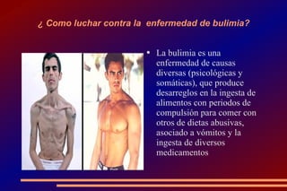 ¿ Como luchar contra la  enfermedad de bulimia? La bulimia es una enfermedad de causas diversas (psicológicas y somáticas), que produce desarreglos en la ingesta de alimentos con periodos de compulsión para comer con otros de dietas abusivas, asociado a vómitos y la ingesta de diversos medicamentos 