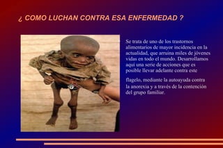 ¿ COMO LUCHAN CONTRA ESA ENFERMEDAD ? Se trata de uno de los trastornos alimentarios de mayor incidencia en la actualidad, que arruina miles de jóvenes vidas en todo el mundo. Desarrollamos aquí una serie de acciones que es posible llevar adelante contra este flagelo, mediante la autoayuda contra   la anorexia y a través de la contención del grupo familiar. 
