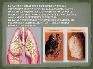 La causa principal de la enfermedad pulmonar obstructiva crónica (EPOC) es el tabaquismo. Cuanto más fume la persona, mayor probabilidad tendrá de desarrollar EPOC, aunque algunas personas fuman por años y nunca padecen esta enfermedad.En raras ocasiones, los no fumadores que carecen de una proteína llamada alfa-1 antitripsina pueden desarrollar enfisema