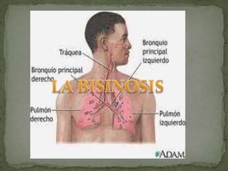      LA BISINOSIS  