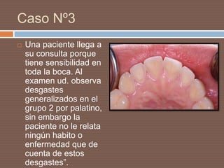 Caso Nº3
 Una paciente llega a
su consulta porque
tiene sensibilidad en
toda la boca. Al
examen ud. observa
desgastes
generalizados en el
grupo 2 por palatino,
sin embargo la
paciente no le relata
ningún habito o
enfermedad que de
cuenta de estos
desgastes”.
 