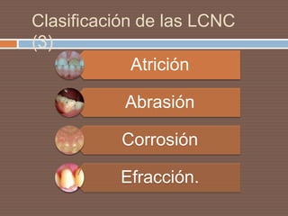 Clasificación de las LCNC
(3)
Atrición
Abrasión
Corrosión
Efracción.
 