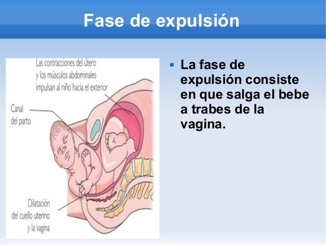 Trabajo del parto