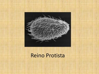 Reino Protista
 