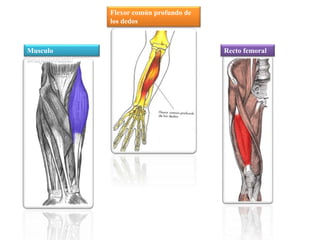 Musculo 
braquiorradial 
Recto femoral 
Flexor común profundo de 
los dedos 
 