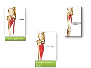 Musculo pectíneo 
Musculo aductor 
largo 
 