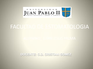 FACULTAD DE ESTOMATOLOGIA 
ALUIMNO: JUAN JESUS PALMA 
DOCENTE: C.D. CRISTIAN GOMEZ 
 