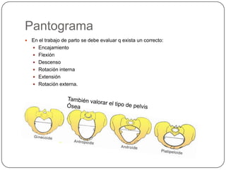 Pantograma En el trabajo de parto se debe evaluar q exista un correcto:EncajamientoFlexión DescensoRotación internaExtensiónRotación externa. También valorar el tipo de pelvis Ósea 