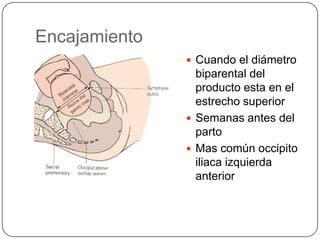 Encajamiento Cuando el diámetro biparental del producto esta en el estrecho superior Semanas antes del partoMas común occipito iliaca izquierda anterior 