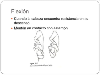 Flexión Cuando la cabeza encuentra resistencia en su descenso.Mentón en contacto con esternón 