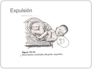 Expulsión 