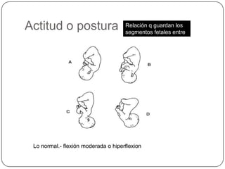 Actitud o postura Relación q guardan los segmentos fetales entre si Lo normal.- flexión moderada o hiperflexion 
