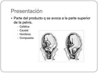 Presentación Parte del producto q se avoca a la parte superior de la pelvis.CefálicaCaudalHombrosCompuesta 