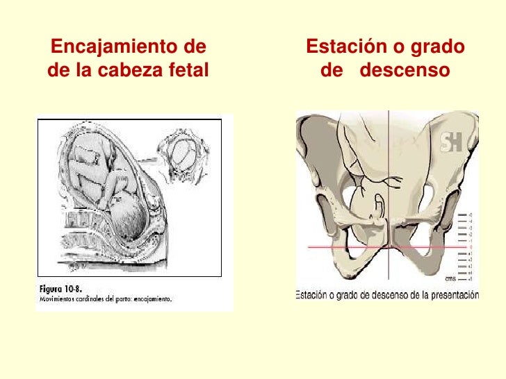 Trabajo de parto