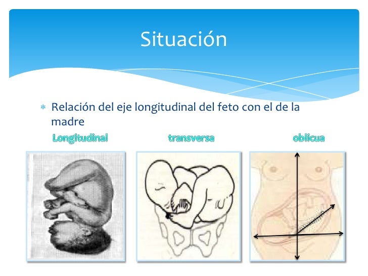 Trabajo de parto