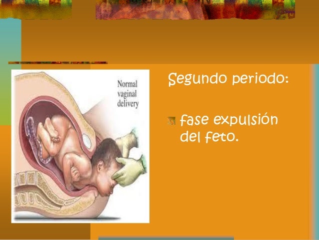 Trabajo de parto
