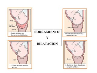 BORRAMIENTO
Y
DILATACION
 
