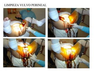LIMPIEZA VULVO PERINEAL
 