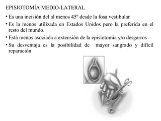 EPISIOTOMÍA MEDIO-LATERAL
• Es una incisión del al menos 45º desde la fosa vestibular
• Es la menos utilizada en Estados Unidos pero la preferida en el
resto del mundo.
• Está menos asociada a extensión de la episiotomía y/o desgarros
• Su desventaja es la posibilidad de mayor sangrado y difícil
reparación
 