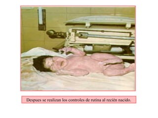 Despues se realizan los controles de rutina al recién nacido.
 