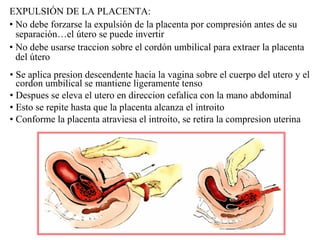 EXPULSIÓN DE LA PLACENTA:
• No debe forzarse la expulsión de la placenta por compresión antes de su
separación…el útero se puede invertir
• No debe usarse traccion sobre el cordón umbilical para extraer la placenta
del útero
• Se aplica presion descendente hacia la vagina sobre el cuerpo del utero y el
cordon umbilical se mantiene ligeramente tenso
• Despues se eleva el utero en direccion cefalica con la mano abdominal
• Esto se repite hasta que la placenta alcanza el introito
• Conforme la placenta atraviesa el introito, se retira la compresion uterina
 