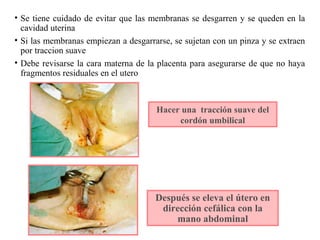 Hacer una tracción suave del
cordón umbilical
Después se eleva el útero en
dirección cefálica con la
mano abdominal
• Se tiene cuidado de evitar que las membranas se desgarren y se queden en la
cavidad uterina
• Si las membranas empiezan a desgarrarse, se sujetan con un pinza y se extraen
por traccion suave
• Debe revisarse la cara materna de la placenta para asegurarse de que no haya
fragmentos residuales en el utero
 