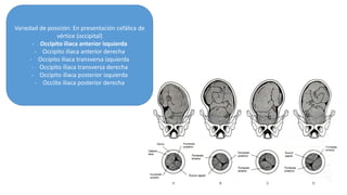 Variedad de posición: En presentación cefálica de
vértice (occipital)
- Occipito iliaca anterior izquierda
- Occipito iliaca anterior derecha
- Occipito iliaca transversa izquierda
- Occipito iliaca transversa derecha
- Occipito iliaca posterior izquierda
- Occiíto iliaca posterior derecha
 