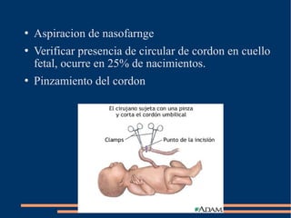  Aspiracion de nasofarnge 
 Verificar presencia de circular de cordon en cuello 
fetal, ocurre en 25% de nacimientos. 
 Pinzamiento del cordon 
 