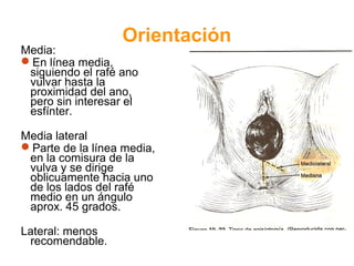 Orientación 
Media: 
En línea media, 
siguiendo el rafé ano 
vulvar hasta la 
proximidad del ano, 
pero sin interesar el 
esfínter. 
Media lateral 
Parte de la línea media, 
en la comisura de la 
vulva y se dirige 
oblicuamente hacia uno 
de los lados del rafé 
medio en un ángulo 
aprox. 45 grados. 
Lateral: menos 
recomendable. 
 