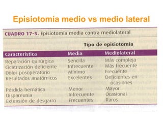 Episiotomía medio vs medio lateral 
 