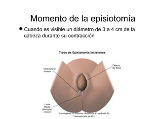 Momento de la episiotomía 
Cuando es visible un diámetro de 3 a 4 cm de la 
cabeza durante su contracción 
Cunningham, G. Williams Obstetricia,21a edición.Ed. 
Panamericana.pp 401. 
 