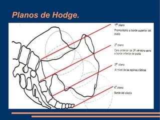 Planos de Hodge. 
 
