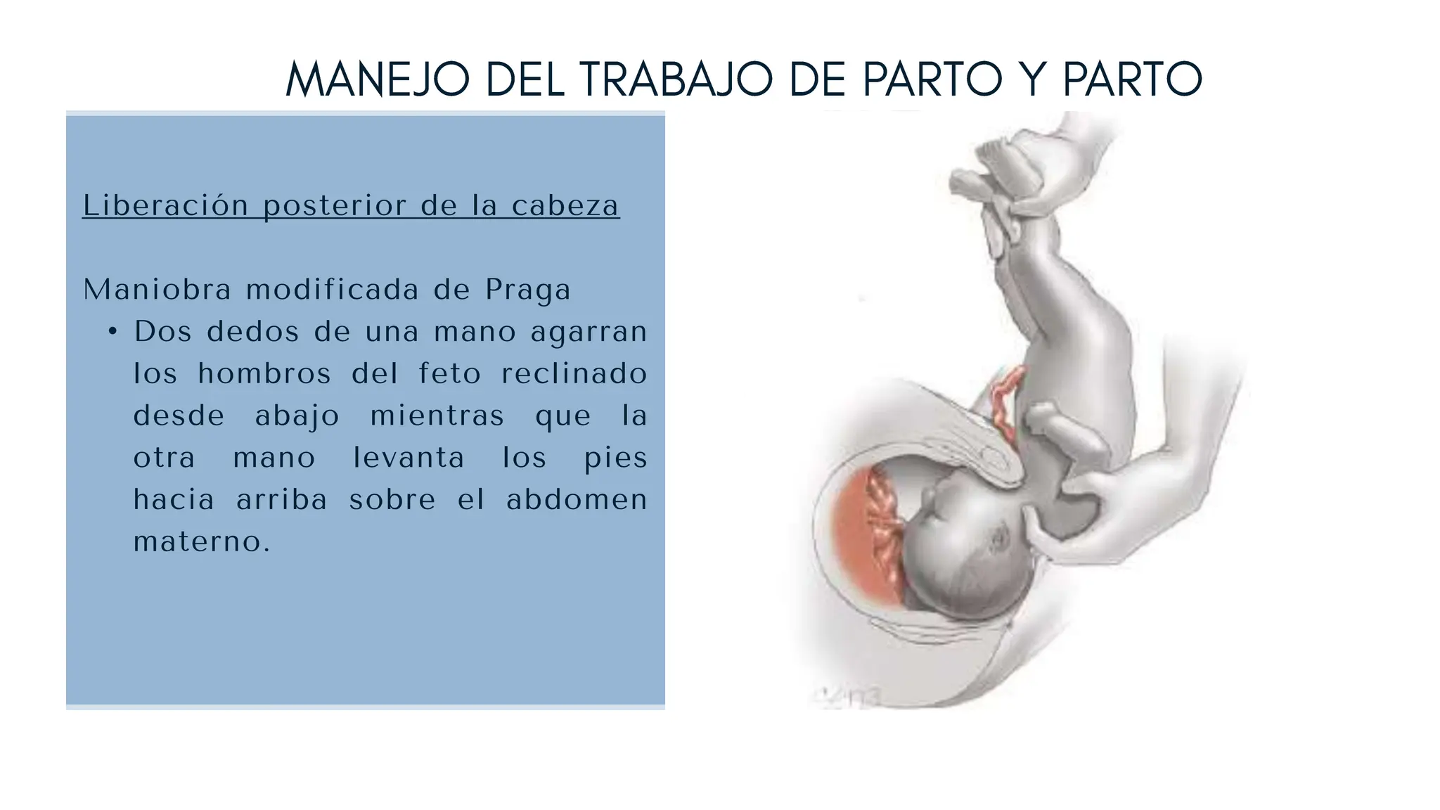 atencion del parto pelviano en hospitales | PPTX