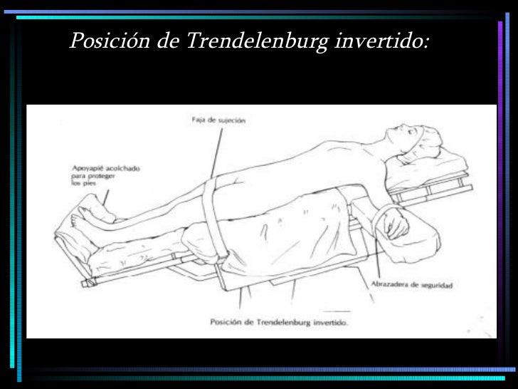 Posicion de Trendelenburg invertido Posicion de Trendelenburg invertido