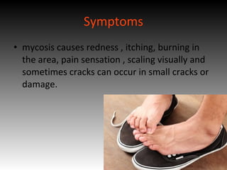 Symptoms
• mycosis causes redness , itching, burning in
the area, pain sensation , scaling visually and
sometimes cracks can occur in small cracks or
damage.
 