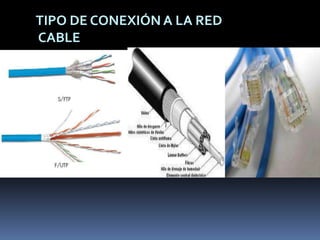 TIPO DE CONEXIÓN A LA RED CABLE